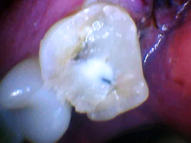 Angelyn Salaberry Kelowna Landmark Dental Centre