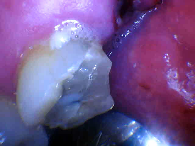 Angelyn Salaberry Kelowna Landmark Dental Centre