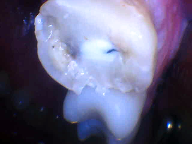 Angelyn Salaberry Kelowna Landmark Dental Centre