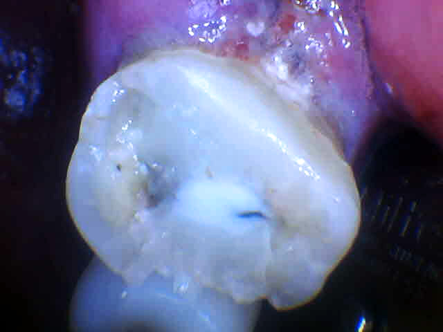 Angelyn Salaberry Kelowna Landmark Dental Centre