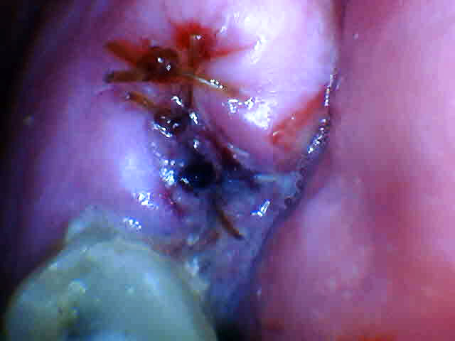 Angelyn Salaberry Kelowna Landmark Dental Centre